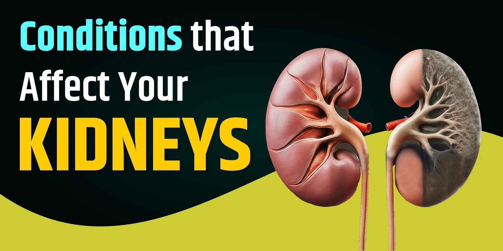 kidney treatment in Ayurveda